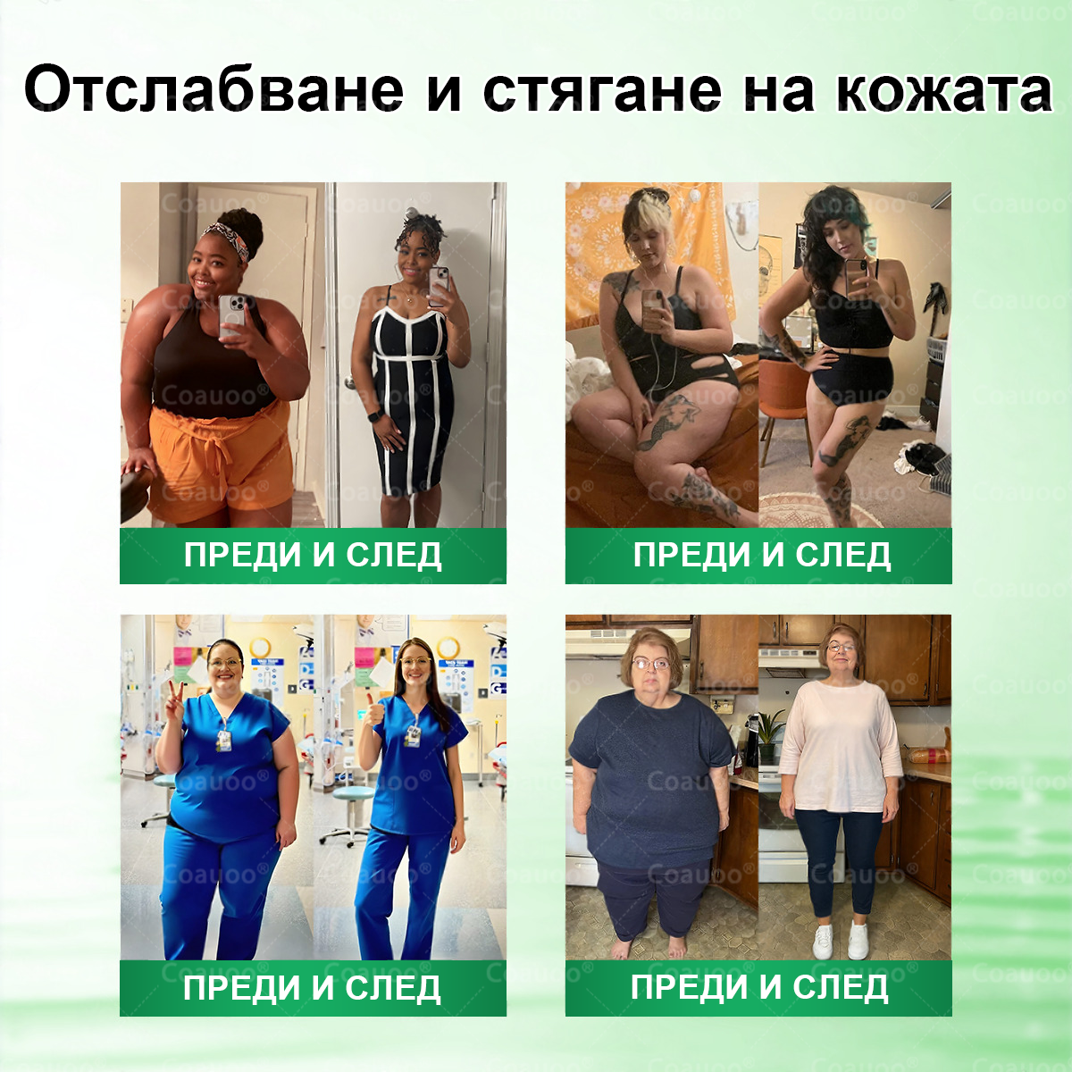 👩‍⚕️ 𝐂𝐨𝐚𝐮𝐨𝐨® 𝐌𝐨𝐫𝐢𝐧𝐠𝐚 × 𝐁𝐞𝐫𝐛𝐞𝐫𝐲𝐧𝐚 × 𝐀𝐌𝐏𝐊 𝟏𝟎 в 𝟏 – Нано микроиглен пластир за отслабване|Само 𝟏× дневно ✅ Видими промени за 𝟕 дни – при затлъстяване, сърдечно-съдово здраве, диабет и ставни проблеми
