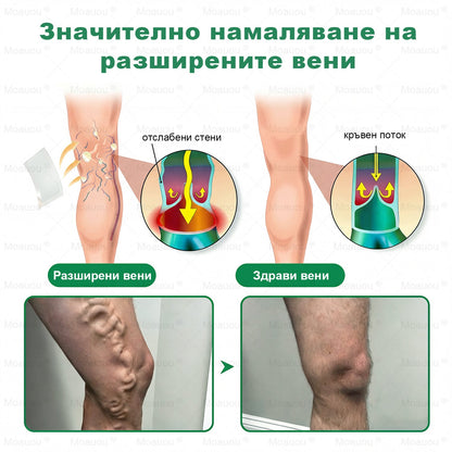 👨‍⚕️✅✅Moauou® Микроиглен пластир за таргетирано действие при разширени вени ⚡Незабавно облекчение, дълготраен ефект — специална промоция