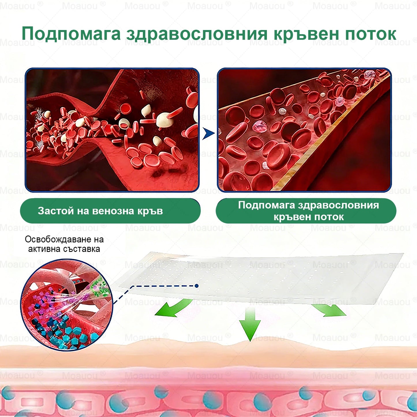 👨‍⚕️✅✅Moauou® Микроиглен пластир за таргетирано действие при разширени вени ⚡Незабавно облекчение, дълготраен ефект — специална промоция