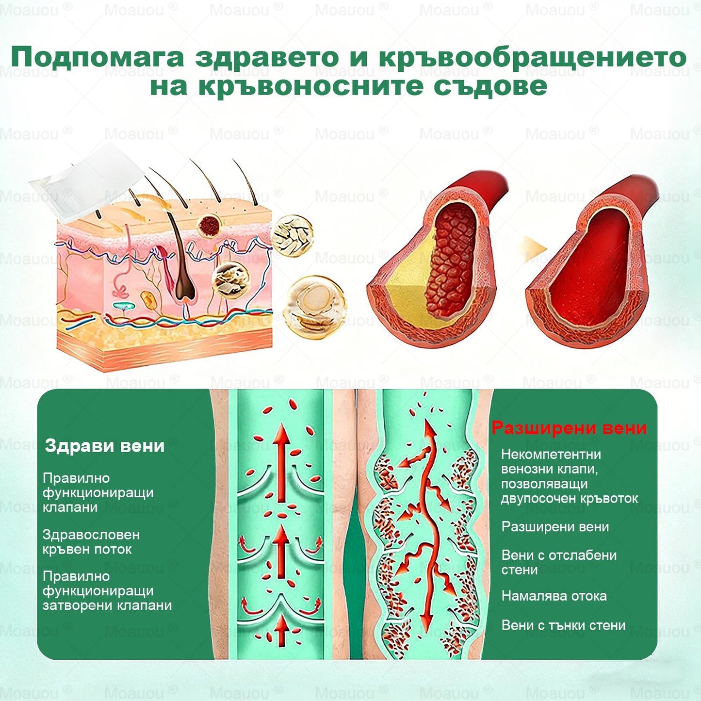 👨‍⚕️✅✅Moauou® Микроиглен пластир за таргетирано действие при разширени вени ⚡Незабавно облекчение, дълготраен ефект — специална промоция