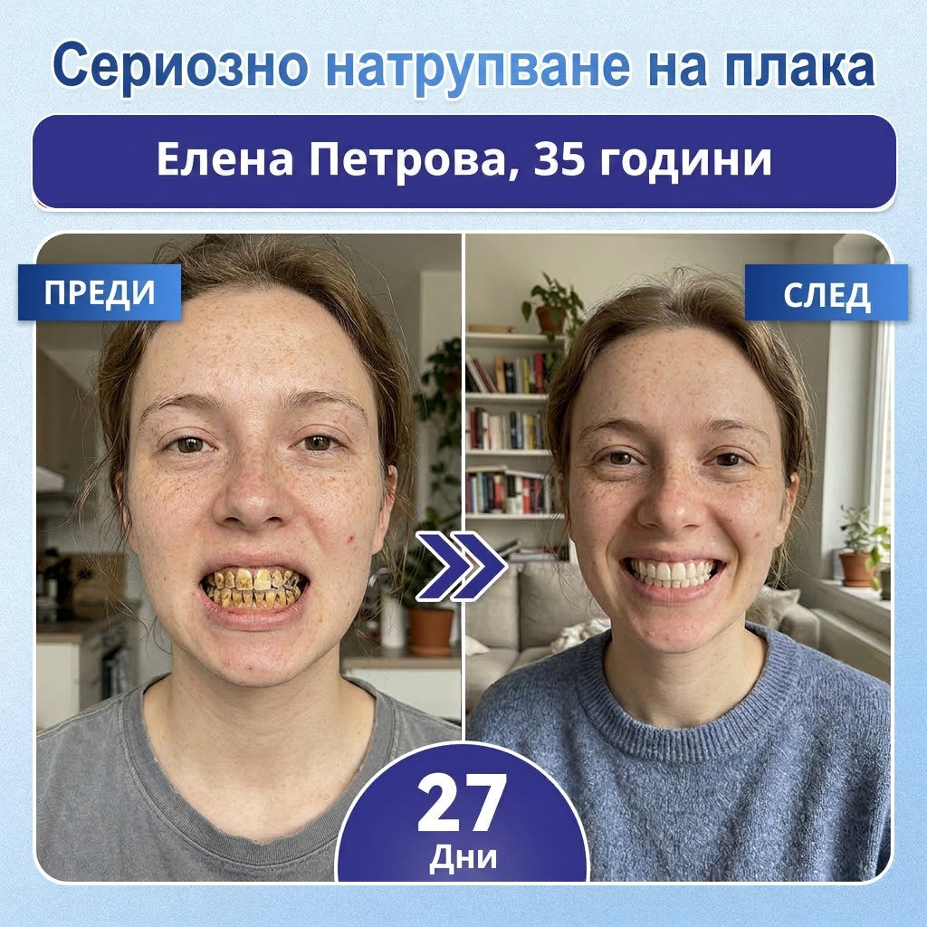 🦷 Кажете сбогом на чувствителността и дискомфорта! 𝐂𝐨𝐚𝐮𝐨𝐨® Tideglusib орални ленти – бързо възстановяване за зъби и венци 😊