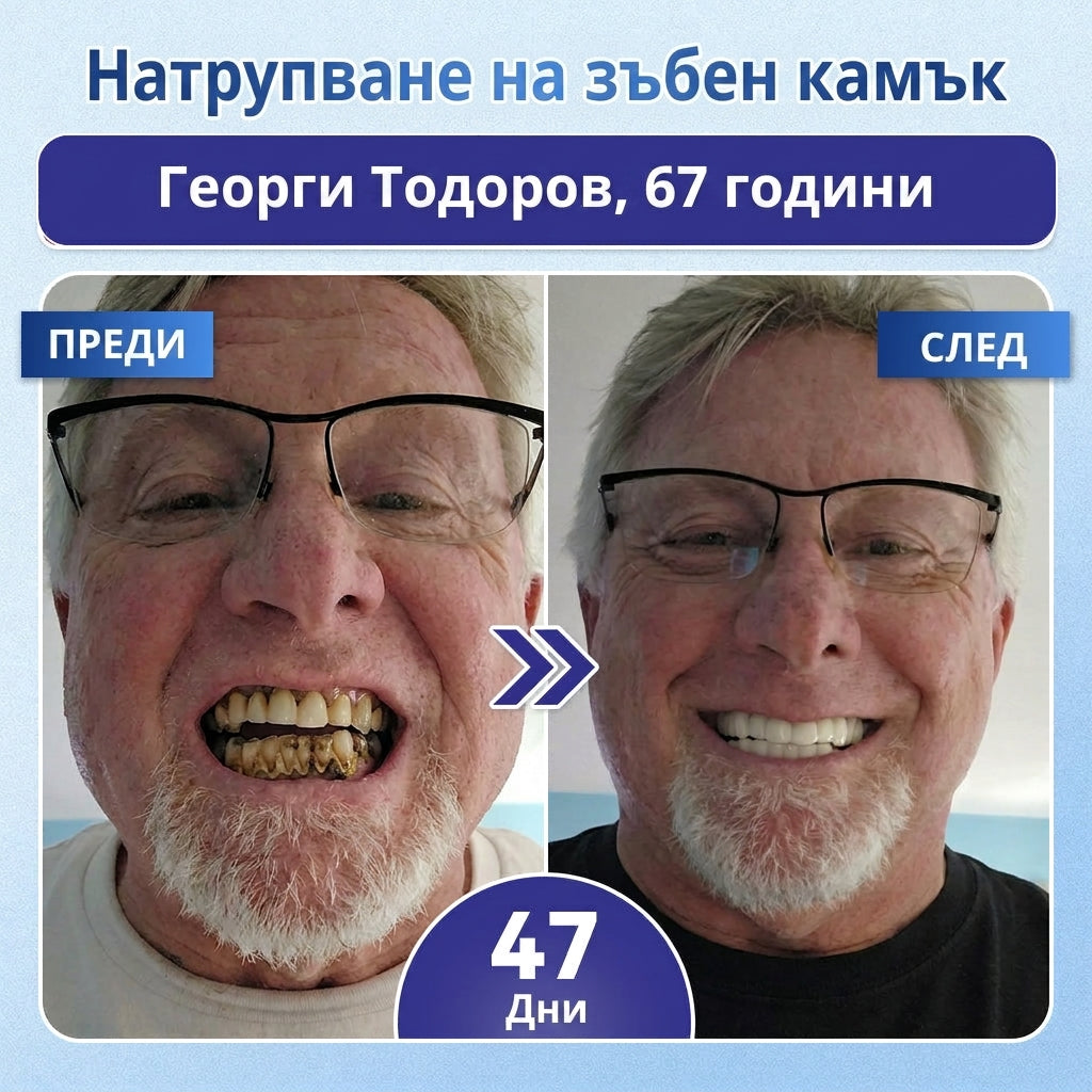 🦷 Кажете сбогом на чувствителността и дискомфорта! 𝐂𝐨𝐚𝐮𝐨𝐨® Tideglusib орални ленти – бързо възстановяване за зъби и венци 😊
