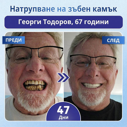 🦷 Кажете сбогом на чувствителността и дискомфорта! 𝐂𝐨𝐚𝐮𝐨𝐨® Tideglusib орални ленти – бързо възстановяване за зъби и венци 😊
