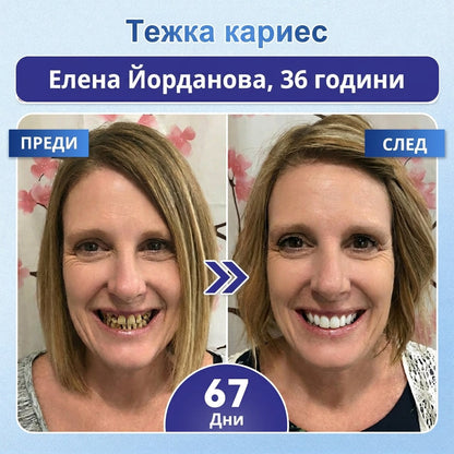 🦷 Кажете сбогом на чувствителността и дискомфорта! 𝐂𝐨𝐚𝐮𝐨𝐨® Tideglusib орални ленти – бързо възстановяване за зъби и венци 😊