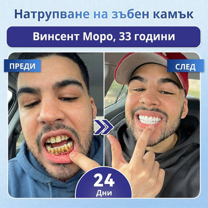 🦷 Кажете сбогом на чувствителността и дискомфорта! 𝐂𝐨𝐚𝐮𝐨𝐨® Tideglusib орални ленти – бързо възстановяване за зъби и венци 😊